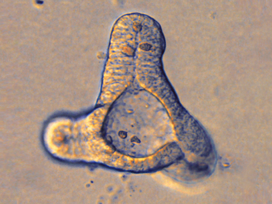 Organoids just a quarter of a millimeter across exhibit functions of the human intestine. (Photo: TUM/ Zietek)