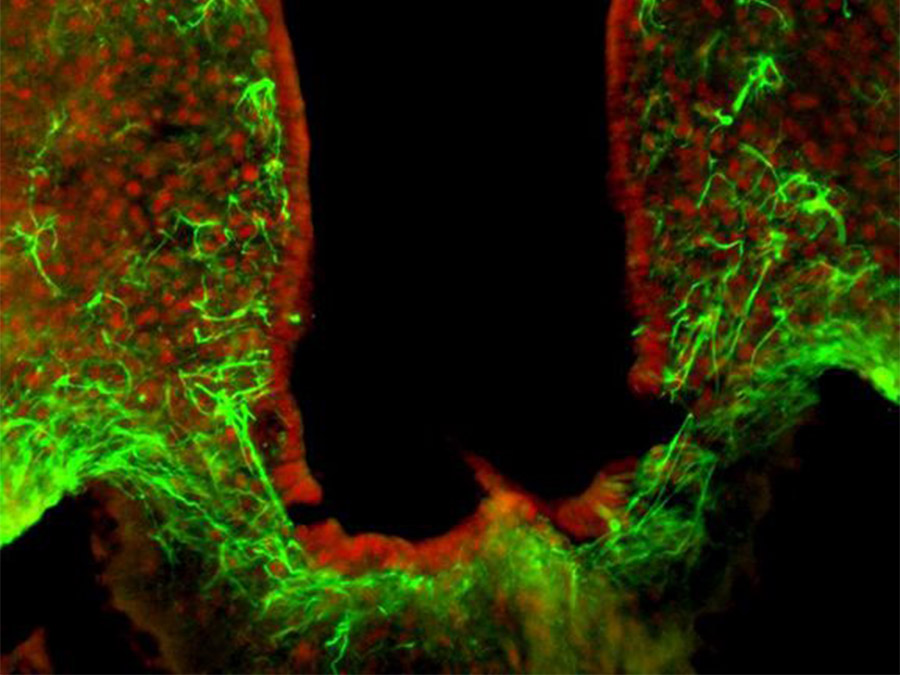 HDAC5 (rot) spielt in Nervenzellen eine wichtige Rolle für die Kontrolle der Nahrungsaufnahme, umliegende Astrozyten sind in grün eingefärbt.