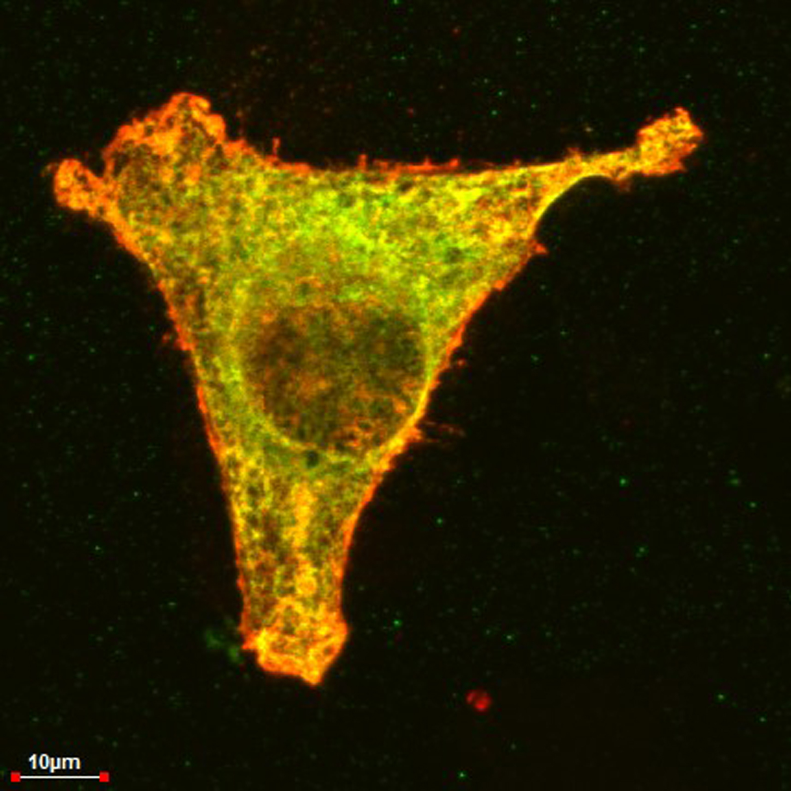 Tumorzelle mit hervorgehobenen Proteinen in der Zellwand (FOTO: Bassermann/TUM)