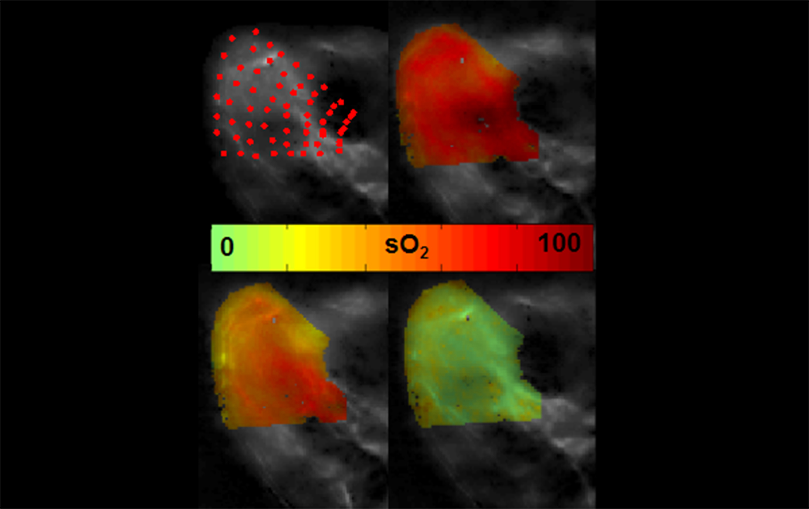 An eMSOT image in which high and low levels of oxygen are shown in red and green (image: Tzoumas / TUM)