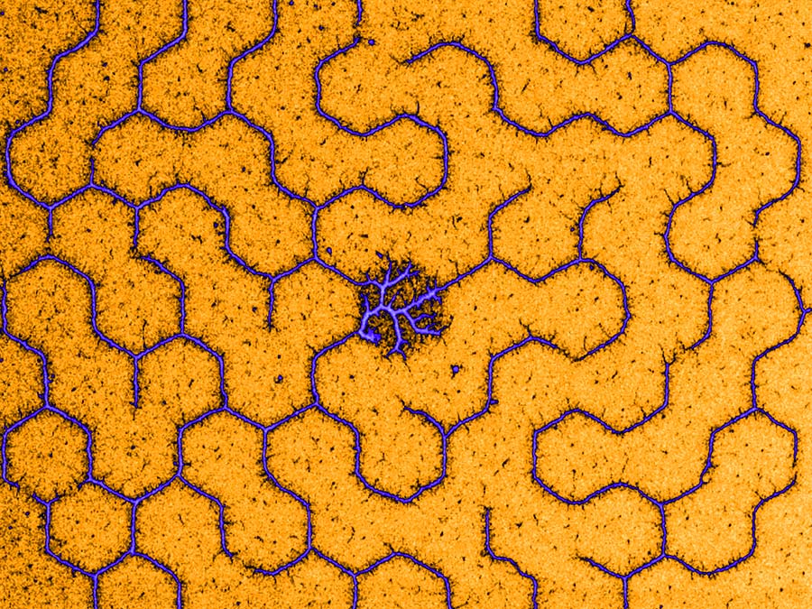 Labyrinth aus kondensierten DNA-Molekülen.