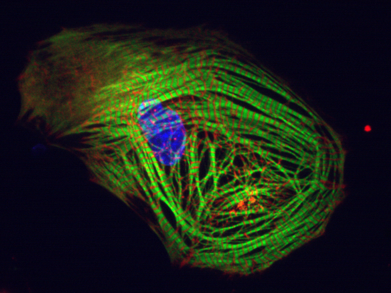 Im Labor gezüchtete Herzzellen werden mithilfe von Quallenproteinen zum Leuchten gebracht. (Foto: Alessandra Moretti /TUM)