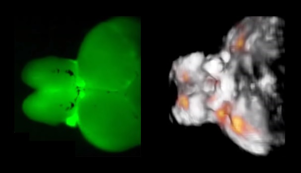 A fluorescence image of a zebrafish brain contrasted with a functional optoacoustic tomography image. (image: Razansky / TUM)