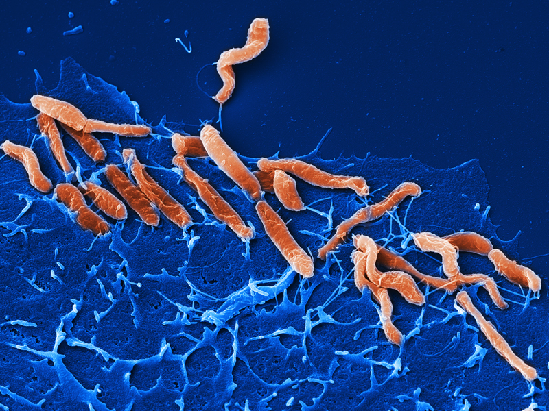 Rasterelektronenmikroskop-Aufnahme von Helicobacter pylori (Bild: M. Rohde/HZI)