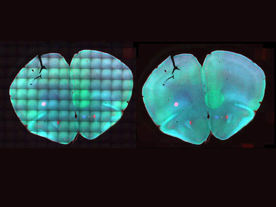 Mosaic image of a mouse brain slice improved by the software BaSiC. (Image: Tingying Peng / TUM/HMGU)