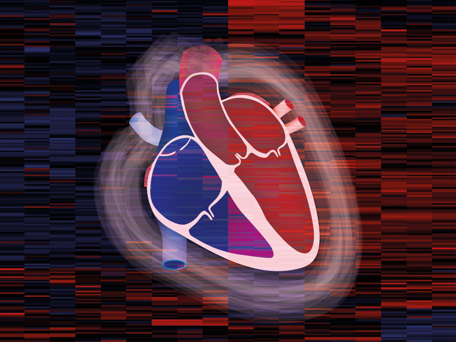 Eine schematische Zeichnung eines Herzmuskels.