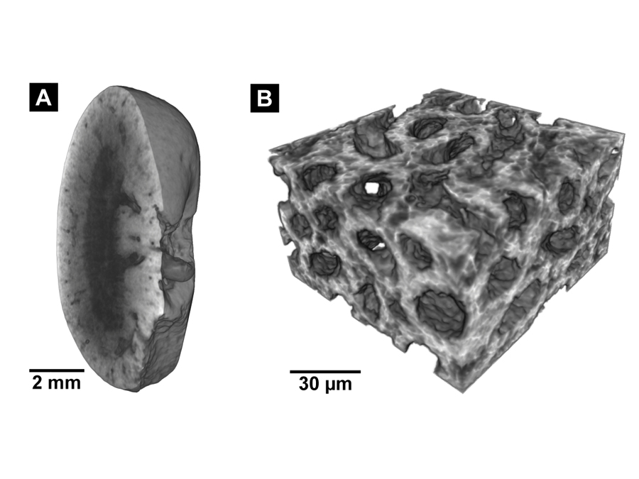 Diese Aufnahmen wurden durch die neue Färbemethode möglich: Links: Micro-CT-Aufnahme einer Mausniere, rechts: Nano-CT-Aufnahme des Gewebes. (Bild: Müller, Pfeiffer / TUM / reproduced with permission from PNAS) Links: Micro-CT-Aufnahme einer Mausniere, rechts: Nano-CT-Aufnahme des Gewebes.