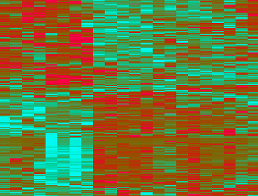 Mithilfe der Proteomanalyse konnten 204 Proteine identifiziert werden, deren Konzentration in den Reizdarm-Überständen anders aussahen als in den Biopsien der anderen Probanden. (Bild: PLOS)