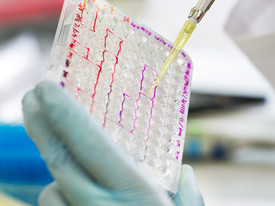 Mit dem neuen molekularbiologischen Ansatz der TUM Wissenschaftler lassen sich zahlreiche Mutationen bei Krebs gleichzeitig im Labor analysieren. (Foto: Astrid Eckert / TUM) Mit dem neuen molekularbiologischen Ansatz der TUM Wissenschaftler lassen sich zahlreiche Mutationen bei Krebs gleichzeitig im Labor analysieren. (Foto: Astrid Eckert / TUM)