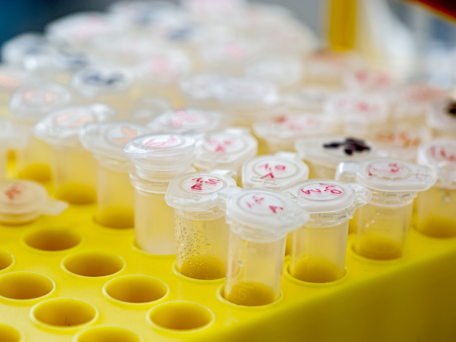 In DNA-Proben von insgesamt elf Patienten fanden die Wissenschaftler Fehler im NBAS-Gen. (Foto: A. Heddergott / TUM) In DNA-Proben von insgesamt elf Patienten fanden die Wissenschaftler Fehler im NBAS-Gen. (Foto: A. Heddergott / TUM)