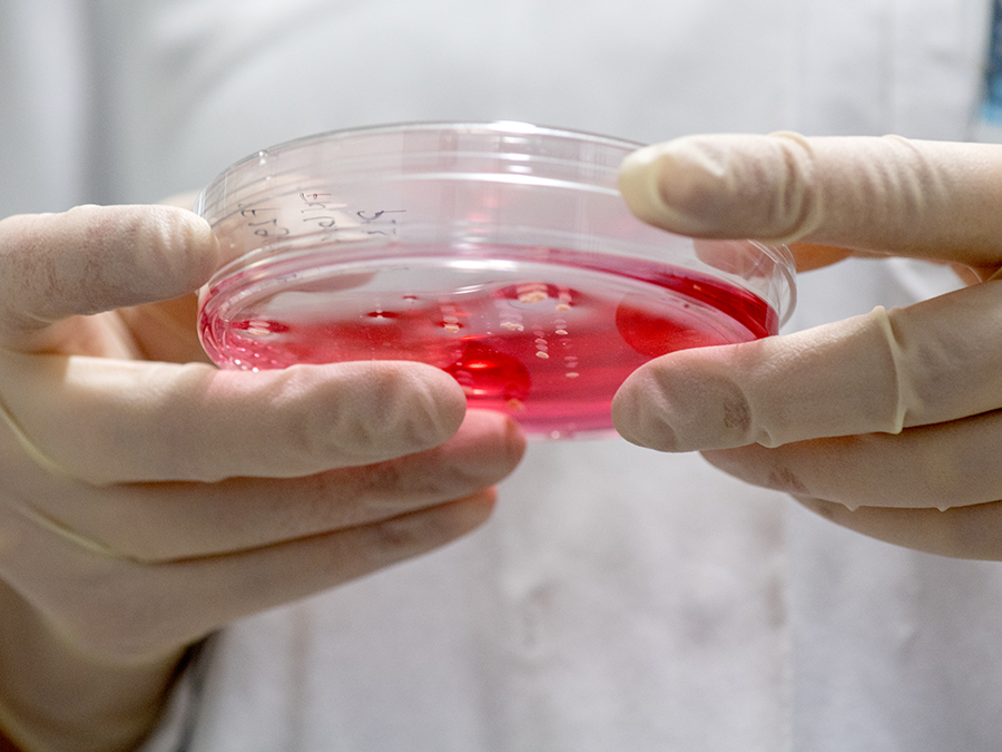 Arbeiten mit Zellkulturen sind in der onkologischen Grundlagenforschung ein wichtiges Werkzeug. (Bild: A. Heddergott / TUM)
