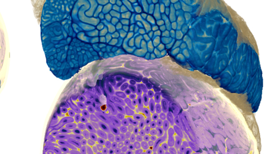 Hohe Auflösung von kleinsten Körperfasern: Weichteile einer Ratte in 3D. Bild: TUM Hohe Auflösung von kleinsten Körperfasern: Weichteile einer Ratte in 3D. Bild: TUM