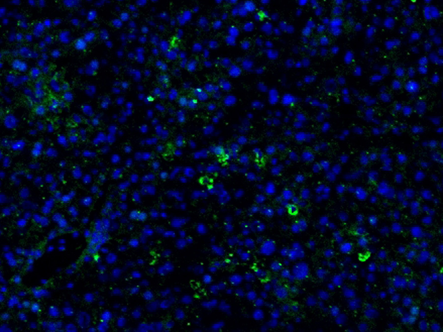 Auf der Abbildung sind Leberzellen zu sehen, deren Zellkerne mit blauem Fluoreszenzfarbstoff angefärbt wurden. In grün ist der metastasenfördernde Botenstoff (SDF1) markiert, dessen Bildung durch TIMP-1 im Lebergewebe ausgelöst wird. (Bild: A. Krüger / TUM)