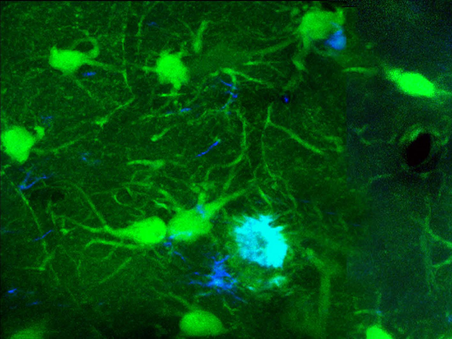 Zwei-Photonen-Mikroskopie: Aufnahme von Zellen (grün) und Amyloid-β Plaques (blau) im Alzheimer-Gehirn. (Bild: Marc Aurel Busche / TUM)