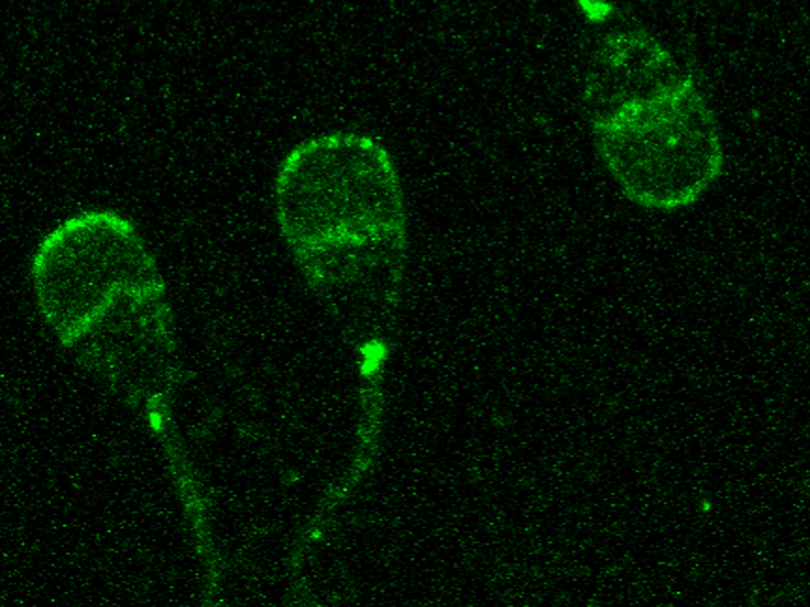 Jetzt identifiziert: Das Protein TMEM95 (grüne Färbung) auf den Spermienköpfen von Rinderbullen. Fehlt es, sind die Tiere unfruchtbar. (Bild: S. Kölle/LMU) Jetzt identifiziert: Das Protein TMEM95 (grüne Färbung) auf den Spermienköpfen von Rinderbullen. Fehlt es, sind die Tiere unfruchtbar.