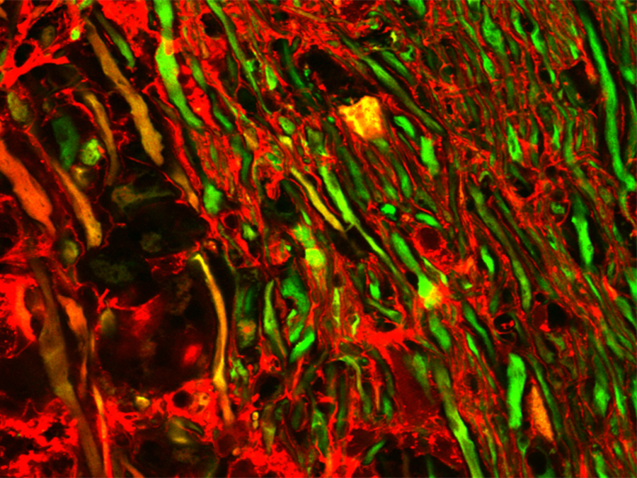 Mikroskopische Aufnahme des Rückenmarks: Geschädigte Nervenfasern nehmen einen roten Fluoreszenzfarbstoff auf, Axone ohne Farbstoffaufnahme erscheinen grün. (Bild: M. Witte / LMU)