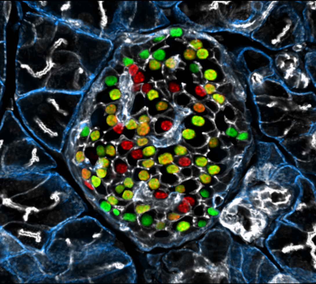 Beta cells marked in green and red. (Photo: Helmholtz Zentrum München)