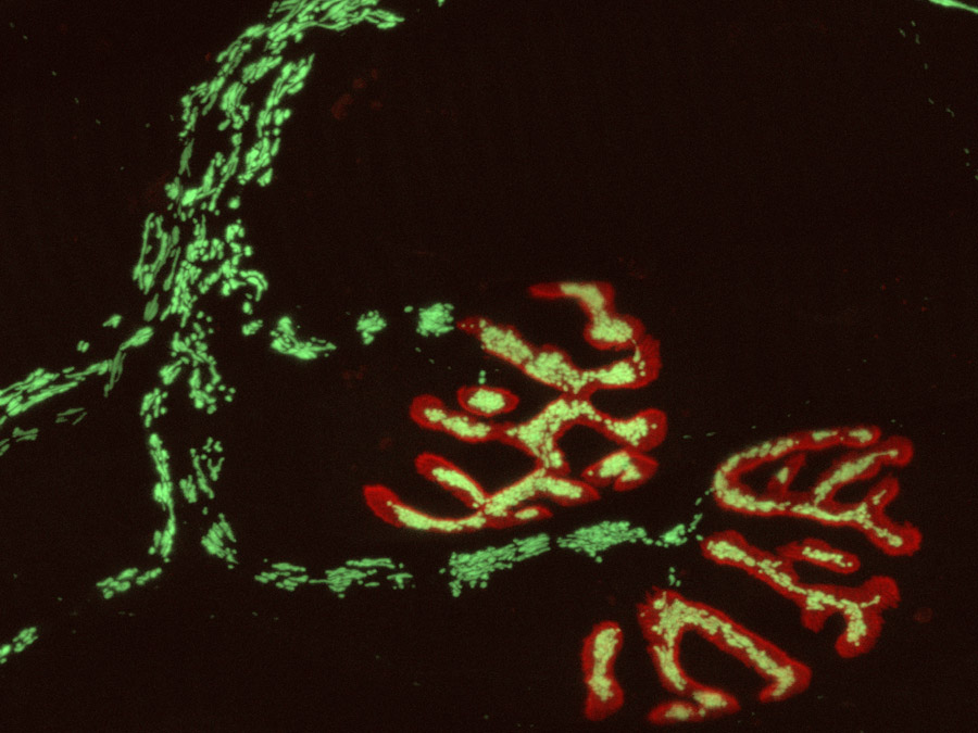 Die Abbildung zeigt einen peripheren Nerven. Die neuromuskulären Endplatten erscheinen in rot, die Mitochondrien der Nervenzellen enthalten einen fluoroszenten Redoxsensor (grün). (Bild: M. Kerschensteiner und T. Misgeld)