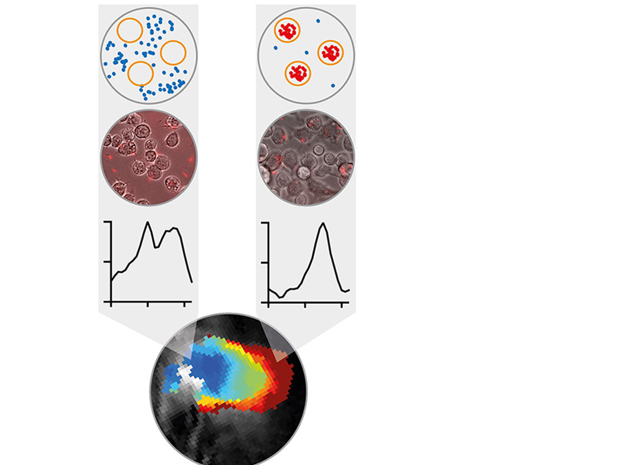 Veränderung des optoakustischen Signals von phototrophen Bakterien durch die Aufnahme von Makrophagen (außerhalb von Makrophagen: blau; innerhalb von Makrophagen: rot). Die in der oberen Reihe schematisch dargestellte Situation kann sowohl im Mikroskop (2. Reihe) als auch mittels MSOT (unten) nachverfolgt werden. Dabei gibt die Veränderung des MSOT-Signals (3. Reihe) Auskunft über die Verteilung von Rhodobacter-Zellen, die sich innerhalb und außerhalb von Makrophagen befinden und damit über ihre Lokalisation und Aktivität. (Bild: Helmholtz Zentrum München)