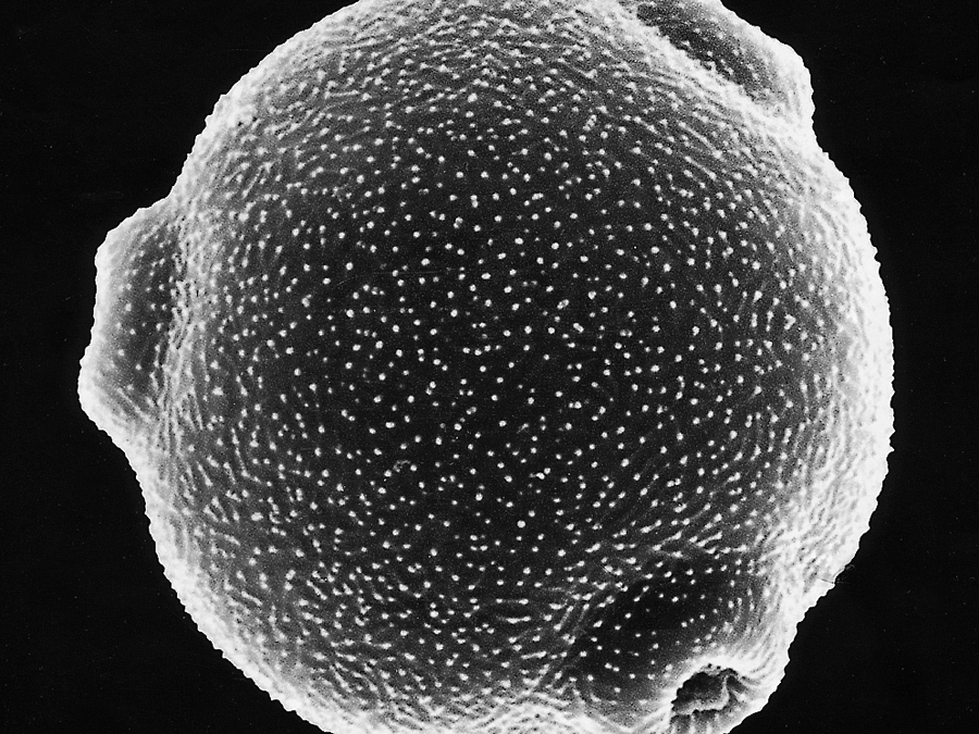 Elektronenmikroskopische Aufnahme eines Birkenpollens