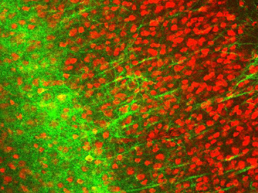 Wie entstehen die langsame Gehirnwellen im Schlaf? Für ihre Versuche haben die Wissenschaftler lichtsensitive Moleküle in spezifische Neuronen (grün im Bild) eingebracht, die auf Licht reagieren.
