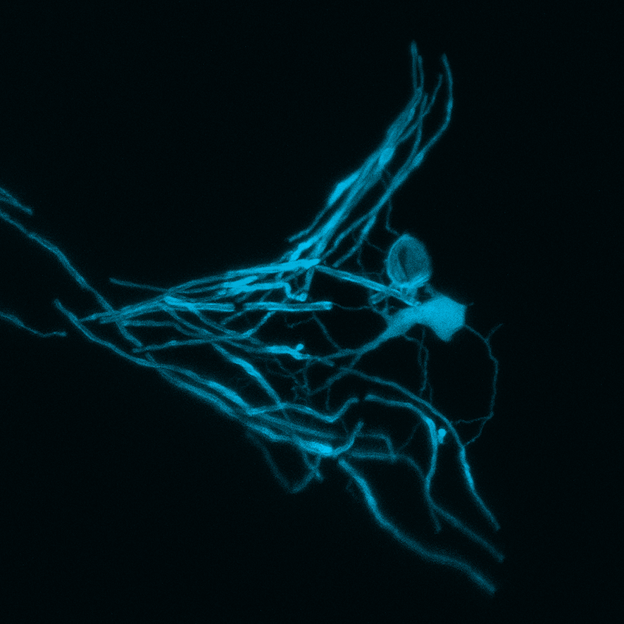 Nerve fibers (axons) are surrounded by a myelin sheath. They are formed by special cells, called oligodendrocytes (seen in the right part of the picture). (image: Czopka /TUM) An oligodendrocyte forming myelin around an axon.