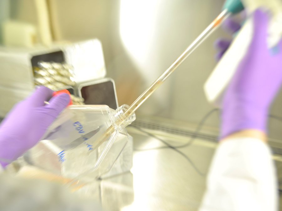 Die Wissenschaftler untersuchten im Labor, welche T-Zellen für die Kontrolle von Virus-assoziierten Tumoren entscheidend sind. (Bild: KKG Päd. Tumorimmunologie / HMGU) Die Wissenschaftler untersuchten im Labor, welche T-Zellen für die Kontrolle von Virus-assoziierten Tumoren entscheidend sind. (Bild: KKG Päd. Tumorimmunologie / HMGU)