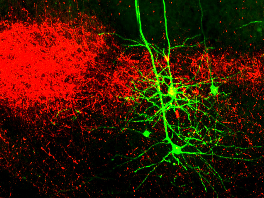 In rot sind Nervenzellen des Kortex angefärbt und in grün die Nervenzellfortsätze des „higher order“- Thalamus. (Bild: R. Mease, M. Metz, A. Groh / Cell Reports, 10.1016/j.celrep.2015.12.026, modifiziert, lizensiert unter CC BY-NC-ND 4.0)