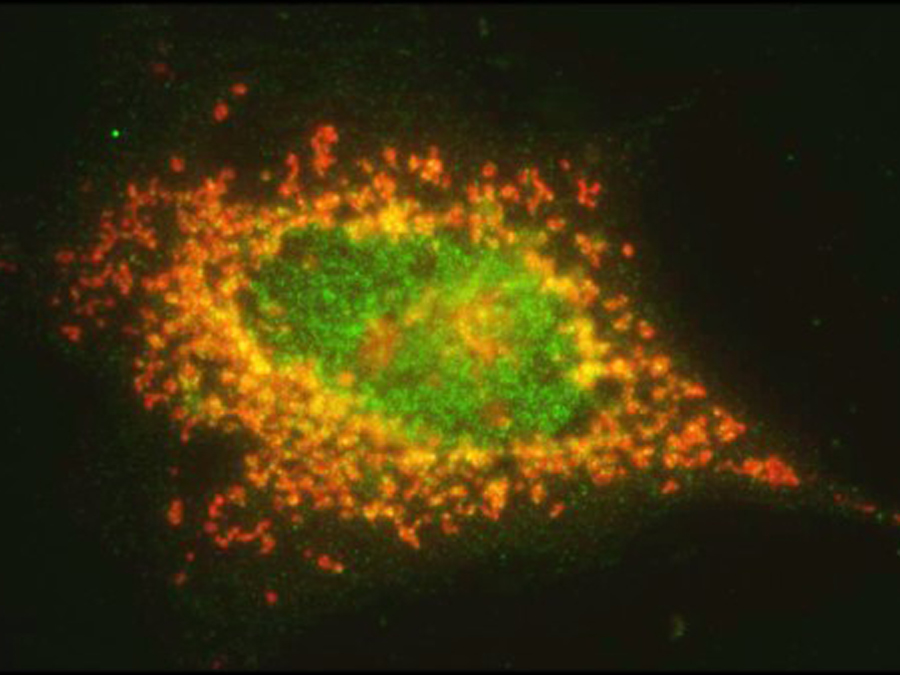 Fluorescence microscopy image showing the ubiquitin ligase FBXO25 (green) and the “life-preserving” protein (red) in a cancer cell that is currently undergoing programmed cell death. The yellow signal indicates instances where both proteins are at the same location. (Picture: F. Bassermann / TUM)