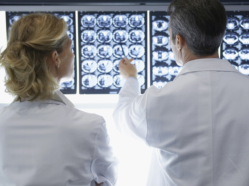 Rear view of a male and female doctor discussing brain scans in hospital.