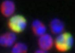 Cell receptors can be detected using specific fluorescent antibodies. Here the yellow staining indicates immune cells with odorant receptors.