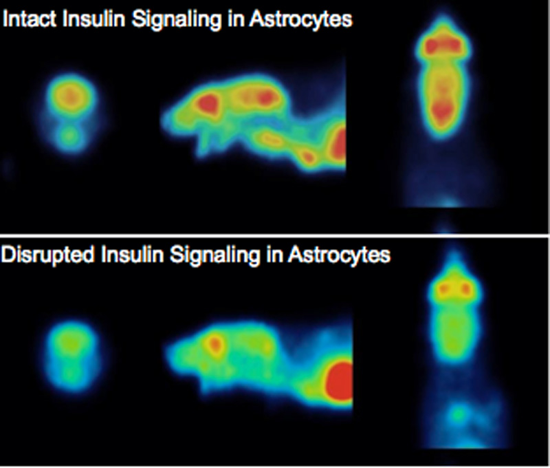 Insulin signaling in astrocytes is required for proper glucose entry to the brain. Above panel: a model of intact insulin signaling in astrocytes and below panel a disrupted model. (Source: Garcia-Caceres)