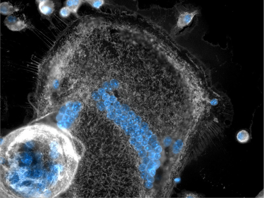 MGCs and macrophages stained with membrane-specific (grey) and nucleus-specific (blue) dyes. One large adherent (center) and one sphere-shaped semi-adherent (lower left corner) MGC are surrounded by a number of mononucleated macrophages. (Picture: Ronny Milde / TUM)