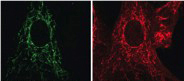 Münchner Wissenschaftler konnten zeigen, dass das Enzym MGME1 (grün), der mitochondrialen DNA (rot) eine wichtige Funktion bei der Vervielfältigung von Mitochondrien hat.