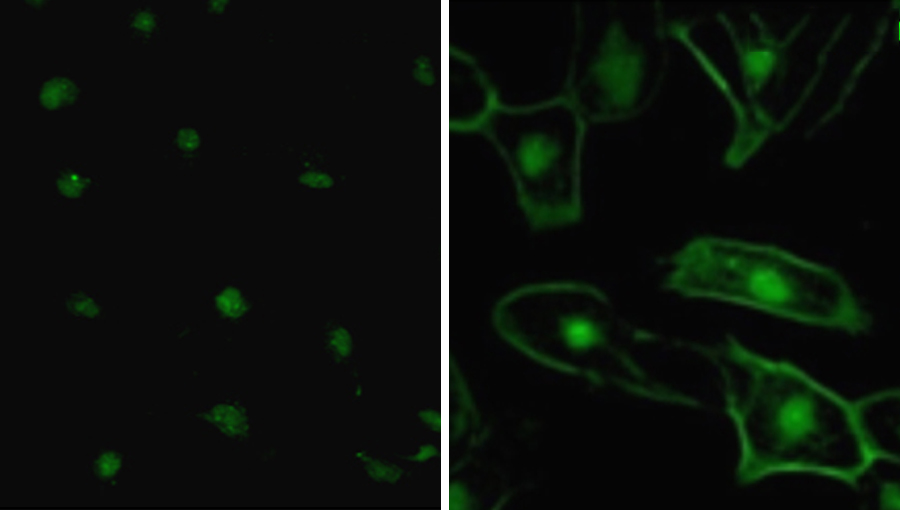 Autoantibodies bind to glial cells