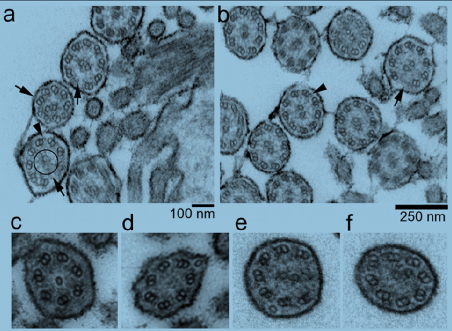 Respiratory cilia of homozygous animals seen through the electron microscopy: The mutation causes for example the absence of a central microtubule pair (circle). (Photo: Figure 3 of the publication) Respiratory cilia of homozygous animals seen through the electron microscopy: The mutation causes for example the absence of a central microtubule pair (circle). (Photo: Figure 3 of the publication)