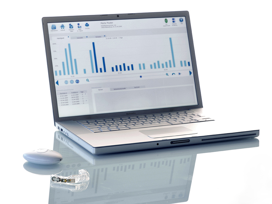 Intelligent tooth splint SensoBite