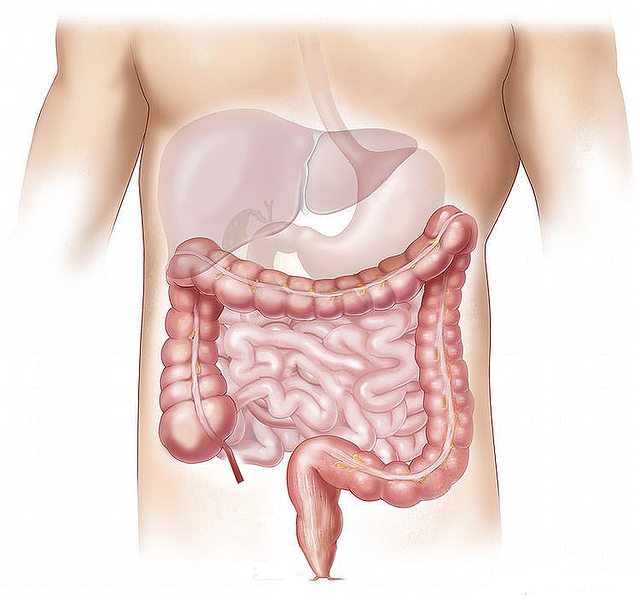 The large intestine - here highlighted dark - is an important part of the digestive tract: If his nervous system is disturbed, this causes chronic constipation, irritable bowel syndrome and inflammatory bowel disease. (Picture: Pixabay / Elionas2)