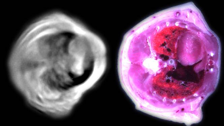 Bild links: Ein mit dem NRT-Verfahren aufgenommenes Querschnittbild einer Maus. Das linke Bild entstand mit einem herkömmlichen Bildgebungsverfahren. Es zeigt die gleiche Region. Bild: V. Ntziachristos/TUM