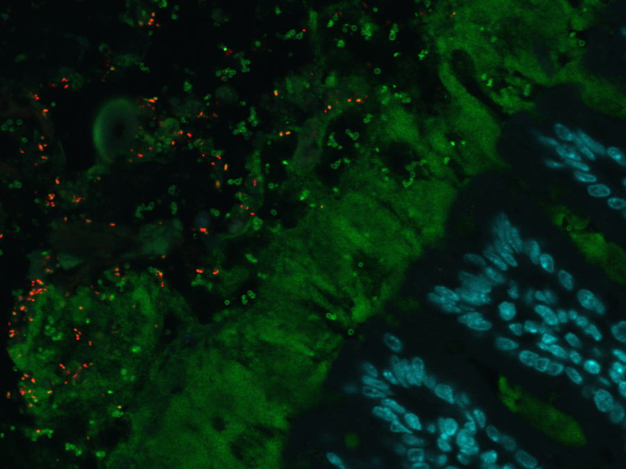 The intestinal microbiome sets the focus for nutrition scientists at TUM. Red: bacteria, green: intestinal mucosa, blue: epithelial cells.