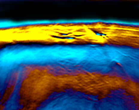 The new laser method MSOT represents brown fat. (Picture: G. Diot/ TUM)