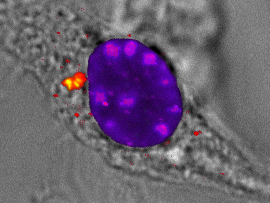 Die Abbildung zeigt eine Fluoreszenzaufnahme von Virus-DNA-Rad50-Card9-Komplexen (gelb) im Zytoplasma (Transmissionsbild) einer Zelle. Nach Infektion der Zelle mit einem DNA-Virus markieren die Wissenschaftler die einzelnen Moleküle, die sie in der Zelle beobachten möchten, mit unterschiedlichen fluoreszierenden Farbstoffen. In blau/magenta leuchtet die DNA, in grün Rad50 und in rot Card9.  (Bild: A. Rottach / LMU)