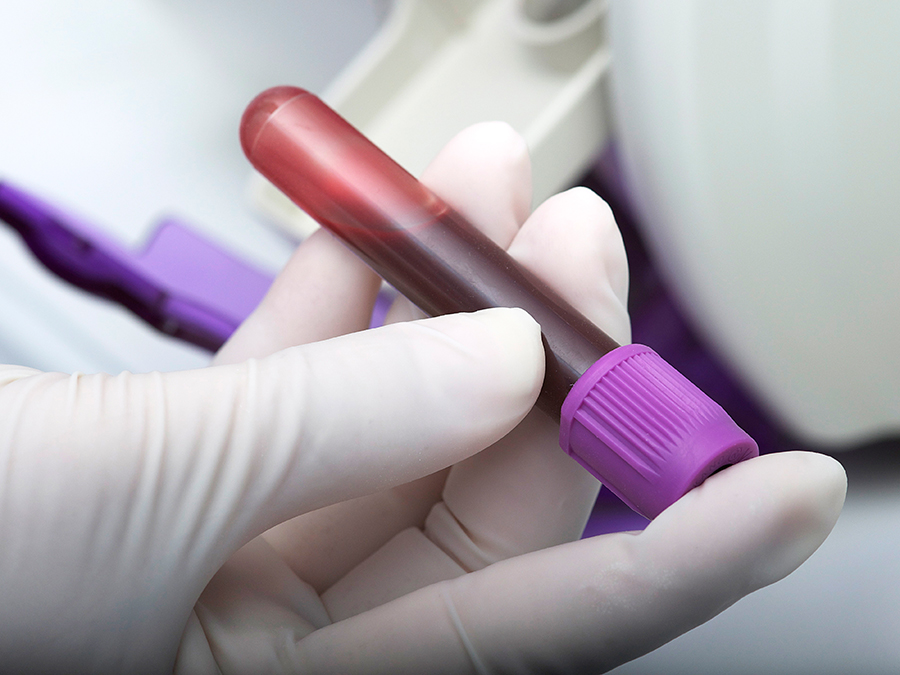 For the new blood test blood samples are taken from the patients and tested for two protein markers. (Image: Gab13 / istockphotos)