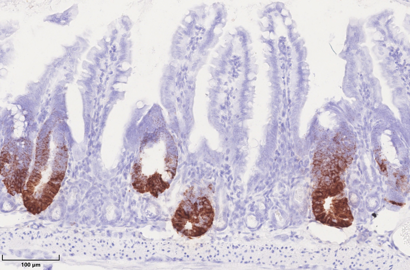 HSP60 in Mitochondrien kontrolliert die Stammzellproliferation im Darmepithel. HSP60-negative Krypten im Darm zeichnen sich durch den Verlust von braungefärbten Stammzellen aus, während HSP60-positive Darmareale eine verstärkte Stammzellproliferation zeigen. (Foto: Team Haller/ TUM)