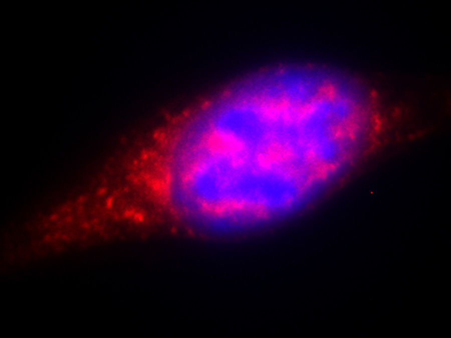 Auf der Abbildung ist eine Gewebezelle des Knochenmarks einer Maus zu sehen, die den Botenstoff CTGF (rot) absondert. Der Zellkern ist in blau angefärbt. (Bild: Rouzanna Istvanffy / TUM)