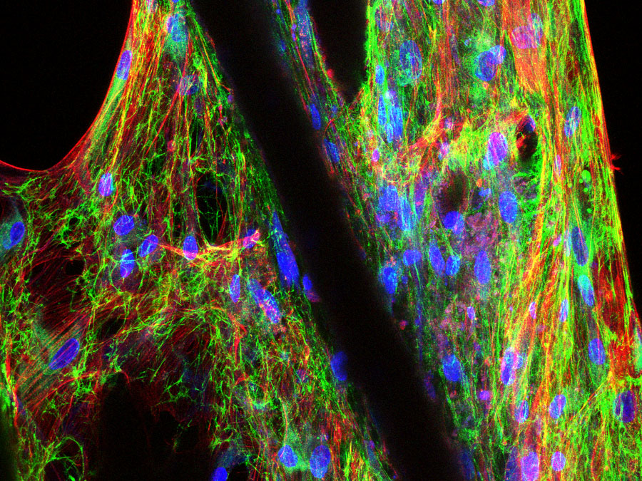 Konfokale Lasermikroskopie eines mit menschlichen mesenchymalen Vorläuferzellen besiedelten Gerüstes (scaffold). Bild: D. Hutmacher / QUT Konfokale Lasermikroskopie eines mit menschlichen mesenchymalen Vorläuferzellen besiedelten Gerüstes (scaffold). Bild: D. Hutmacher / QUT