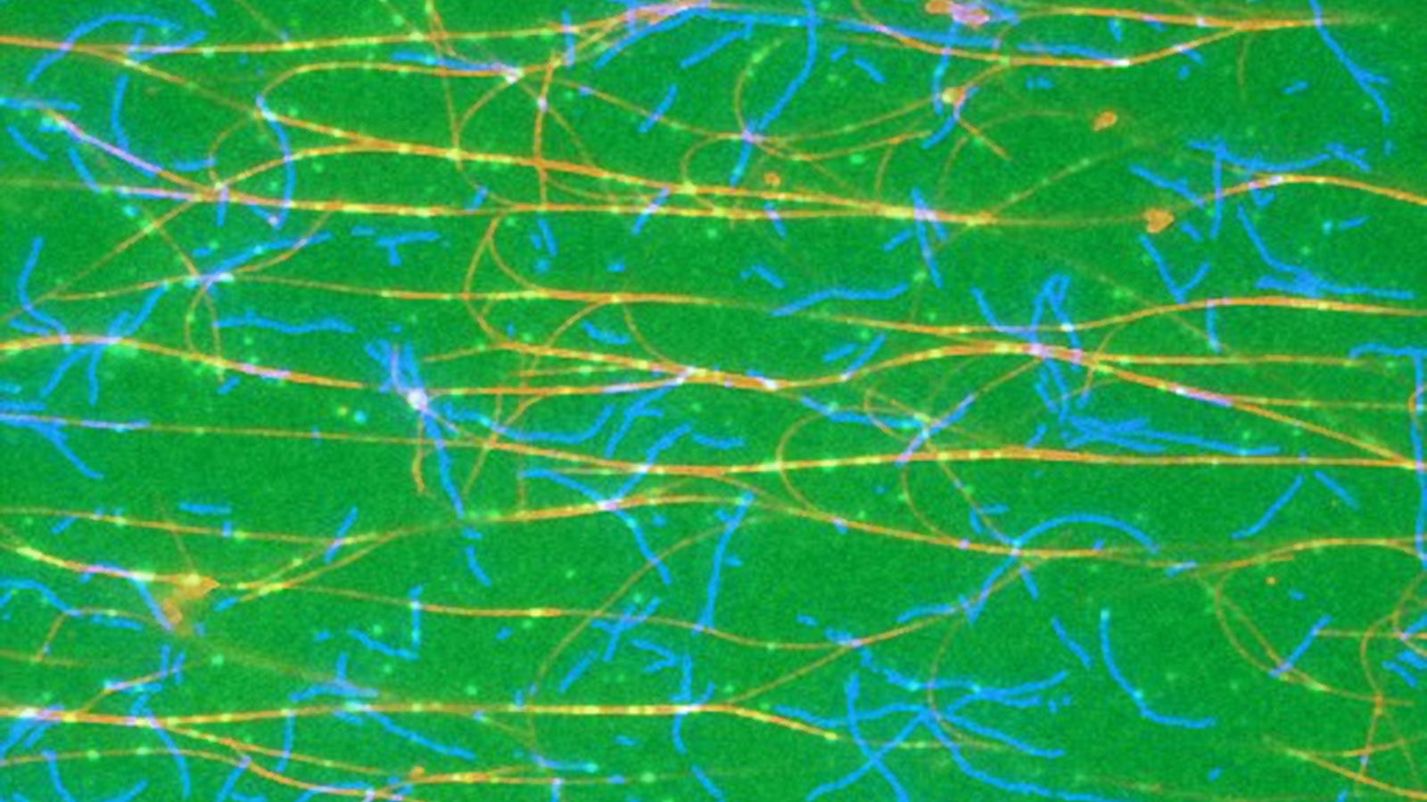 Mikroskopbild des Zytoskeletts einer Zelle. Aktin-Filamente sind blau und Mikrotubuli sind rot dargestellt. Die Transporter sind als hellgrüne Punkte zu erkennen. 