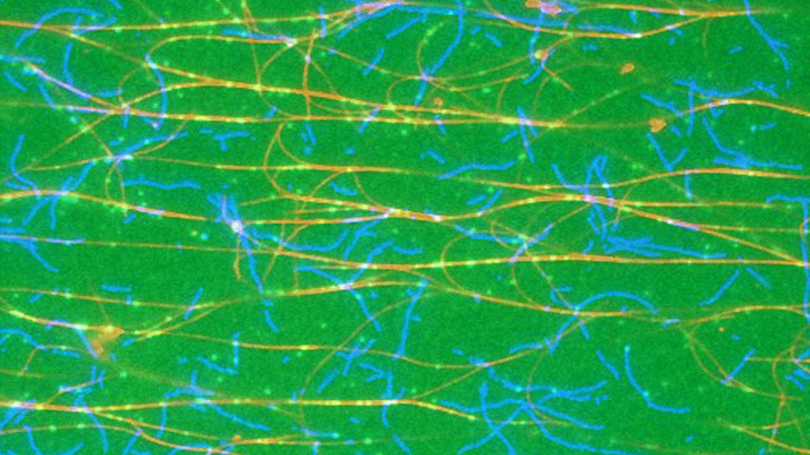 Microscopic image of a cell's cytoskeleton. Actin filaments are blue and microtubules are shown in red. The transporters can be seen as light green dots.