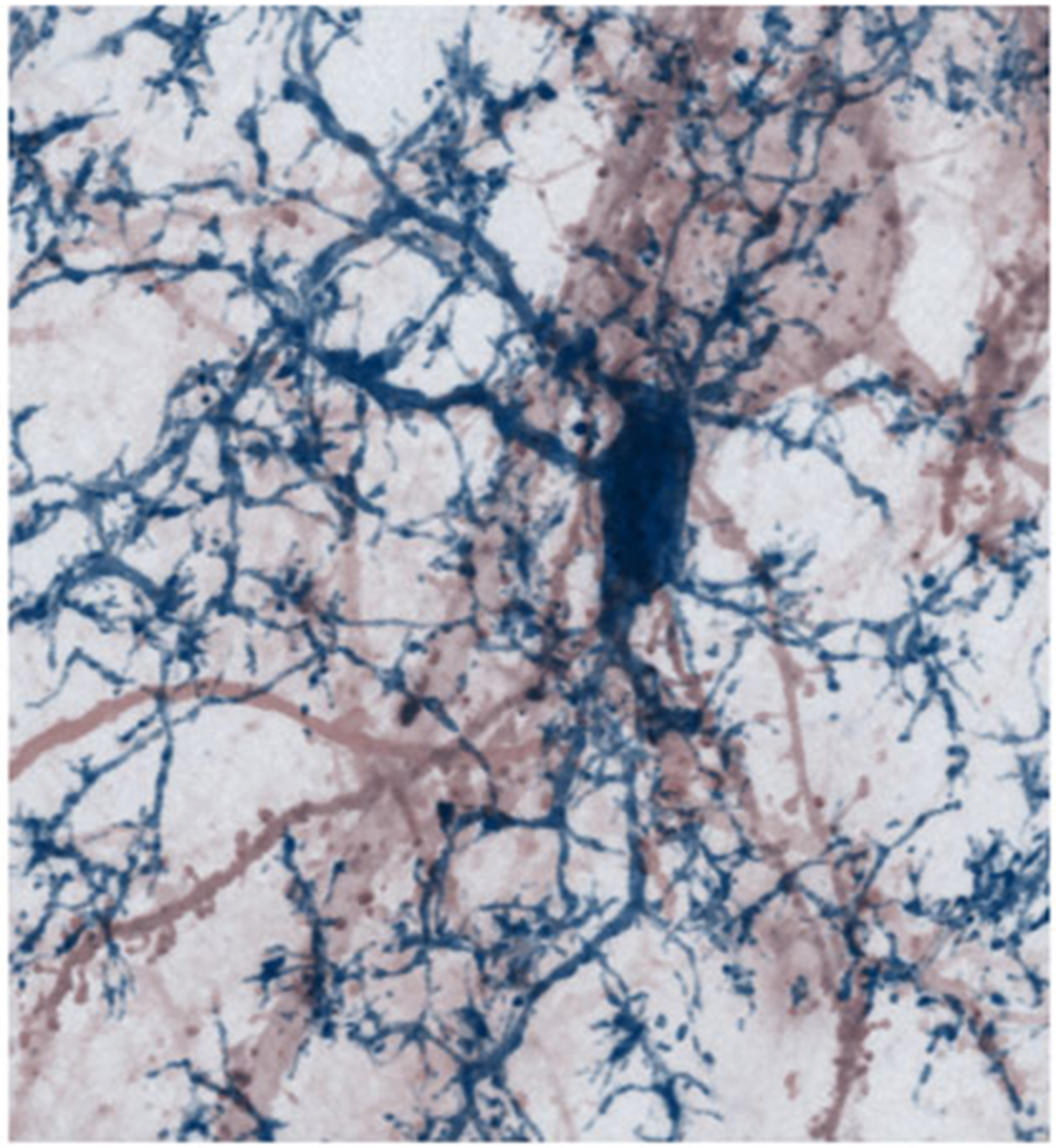 A nerve cell with its dendritic processes studded by synaptic spines (red) being contacted by brain-resident microglia cell (blue) in a mouse brain. 