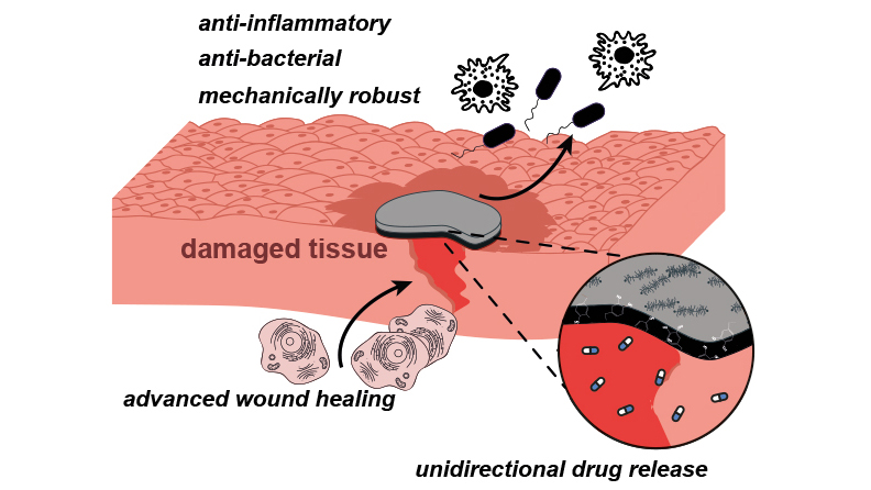 Schematic representation of the most important functional principles of the newly developed film for woundhealing.